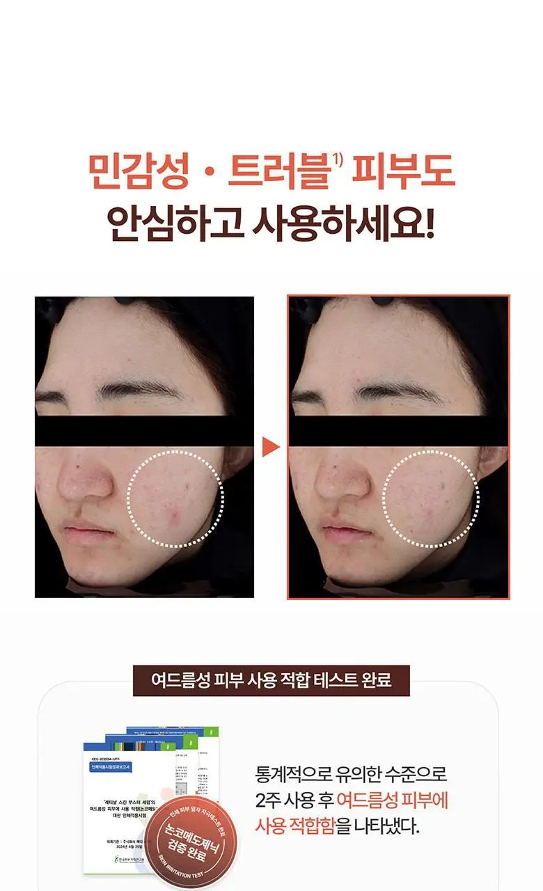 [피부결/흔적개선] 메디테라피 레티날 스킨 부스터 세럼 150ml 상세페이지 25